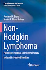 Non-Hodgkin Lymphoma