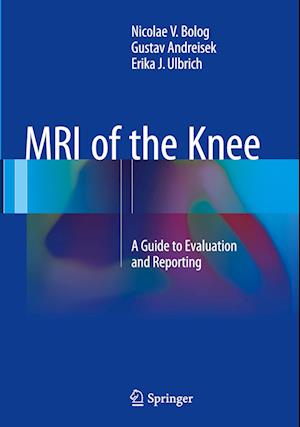 MRI of the Knee