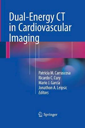 Dual-Energy CT in Cardiovascular Imaging