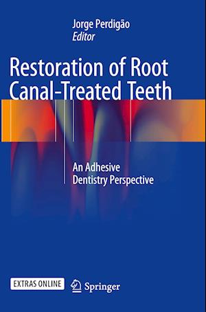 Restoration of Root Canal-Treated Teeth