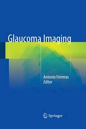 Glaucoma Imaging