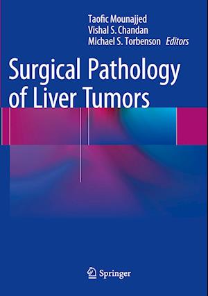 Surgical Pathology of Liver Tumors