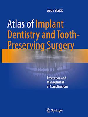 Atlas of Implant Dentistry and Tooth-Preserving Surgery