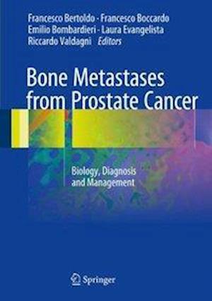 Bone Metastases from Prostate Cancer