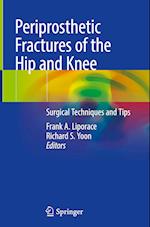 Periprosthetic Fractures of the Hip and Knee