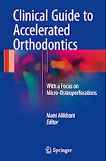 Clinical Guide to Accelerated Orthodontics