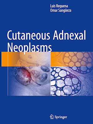 Cutaneous Adnexal Neoplasms