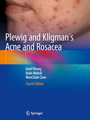 Plewig and Kligman´s Acne and Rosacea