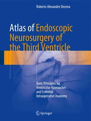 Atlas of Endoscopic Neurosurgery of the Third Ventricle