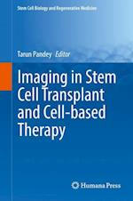 Imaging in Stem Cell Transplant and Cell-based Therapy