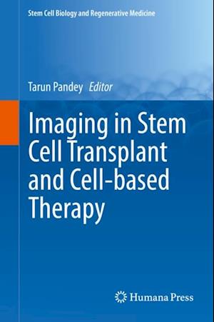 Imaging in Stem Cell Transplant and Cell-based Therapy