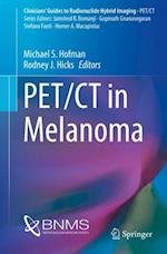 PET/CT in Melanoma