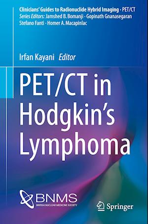 PET/CT in Hodgkin’s Lymphoma