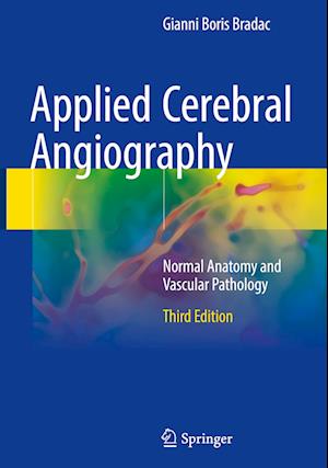 Applied Cerebral Angiography