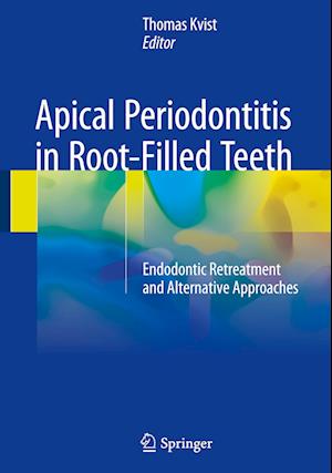 Apical Periodontitis in Root-Filled Teeth