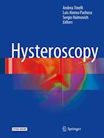 Hysteroscopy