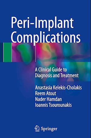 Peri-Implant Complications