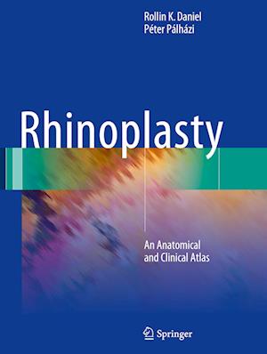 Rhinoplasty