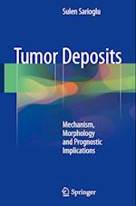 Tumor Deposits