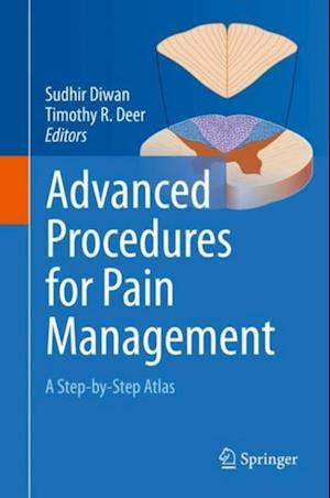 Advanced Procedures for Pain Management