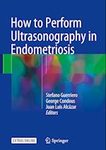 How to Perform Ultrasonography in Endometriosis