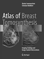 Atlas of Breast Tomosynthesis