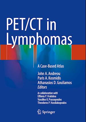 PET/CT in Lymphomas