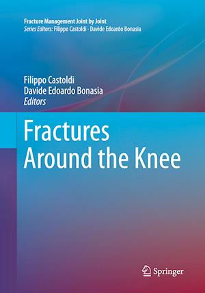 Fractures Around the Knee