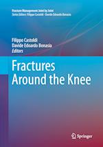 Fractures Around the Knee