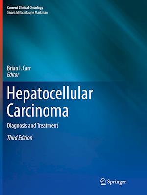 Hepatocellular Carcinoma