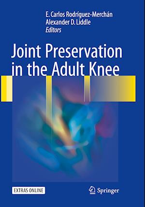 Joint Preservation in the Adult Knee