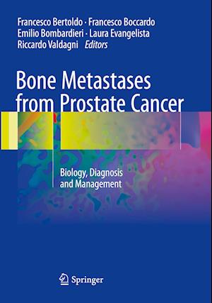 Bone Metastases from Prostate Cancer