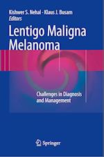 Lentigo Maligna Melanoma