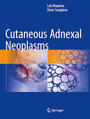 Cutaneous Adnexal Neoplasms