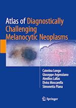 Atlas of Diagnostically Challenging Melanocytic Neoplasms
