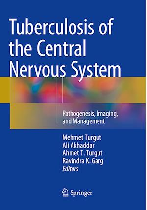 Tuberculosis of the Central Nervous System