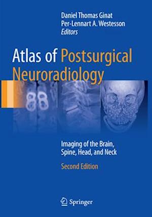 Atlas of Postsurgical Neuroradiology