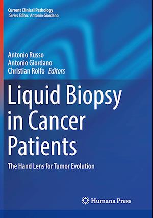 Liquid Biopsy in Cancer Patients