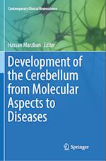 Development of the Cerebellum from Molecular Aspects to Diseases