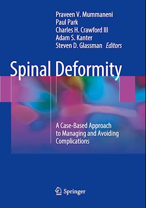 Spinal Deformity