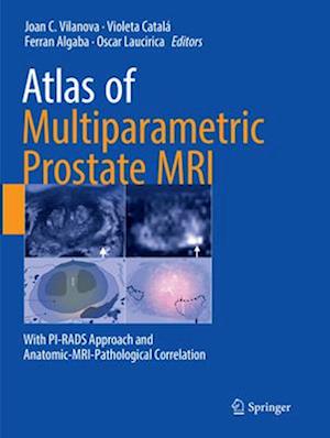 Atlas of Multiparametric Prostate MRI