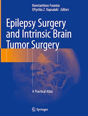 Epilepsy Surgery and Intrinsic Brain Tumor Surgery