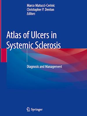 Atlas of Ulcers in Systemic Sclerosis