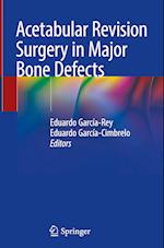 Acetabular Revision Surgery in Major Bone Defects