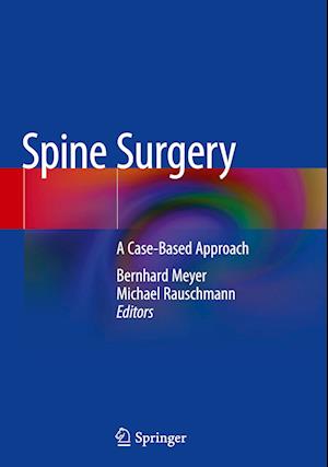 Spine Surgery