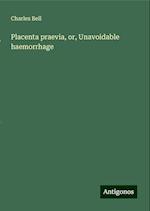 Placenta praevia, or, Unavoidable haemorrhage