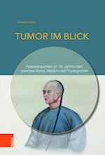 Tumor Im Blick