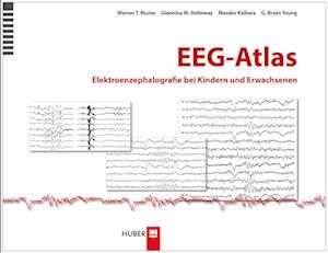 EEG-Atlas