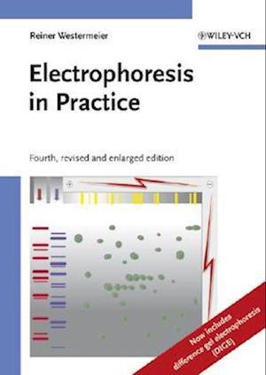 Electrophoresis in Practice