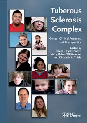 Tuberous Sclerosis Complex